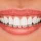 اهمیت ویزیت منظم دندانپزشکی