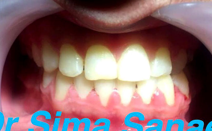 ارتودنسی دندان در مشهد ۲