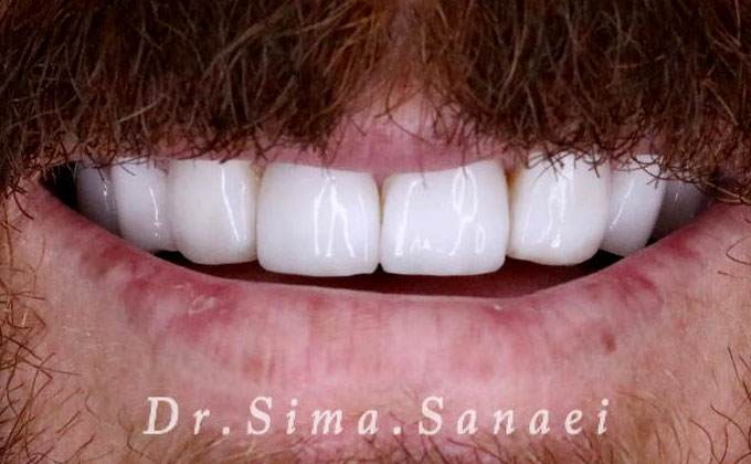 ارتودنسی دندان در مشهد ۳