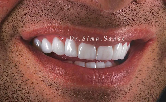 بهترین دندانپزشک زیبایی مشهد ۳