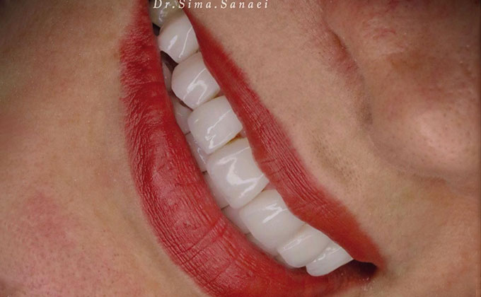 بهترین دندانپزشک زیبایی مشهد