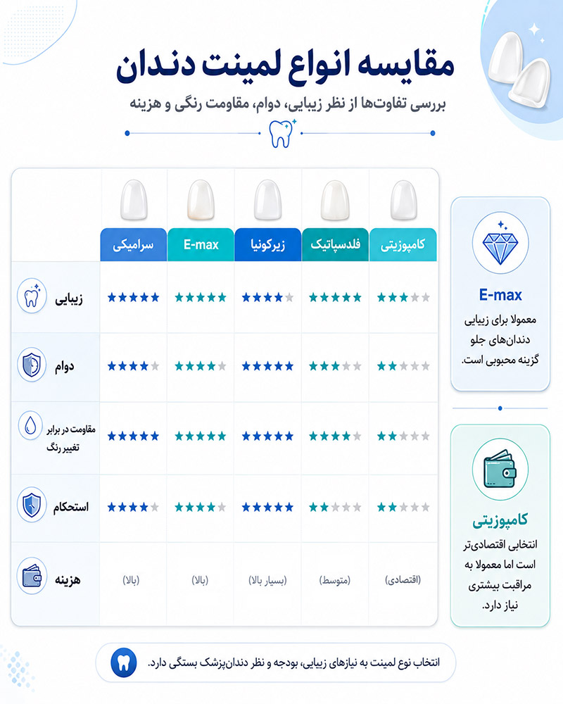 مقایسه انواع لمینت دندان