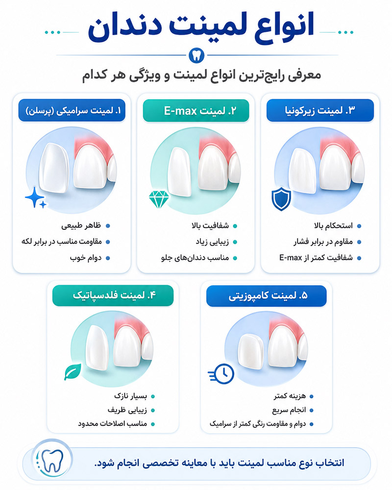 انواع لمینت دندان بر چه اساسی دسته‌بندی می‌شوند