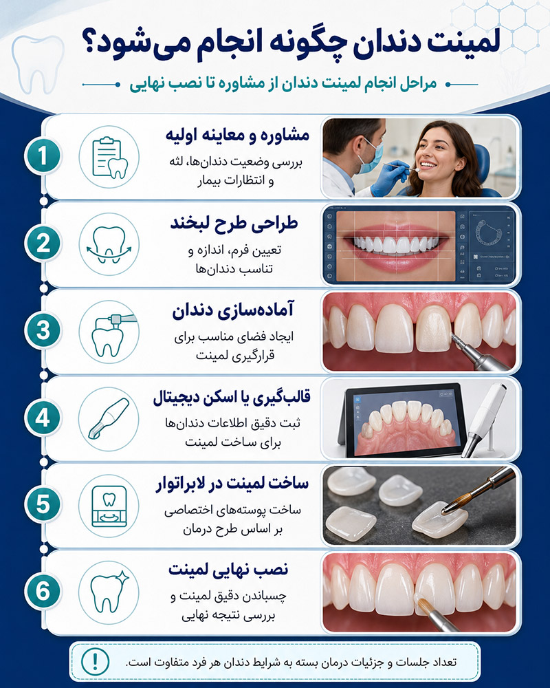 لمینت دندان چگونه انجام میشود