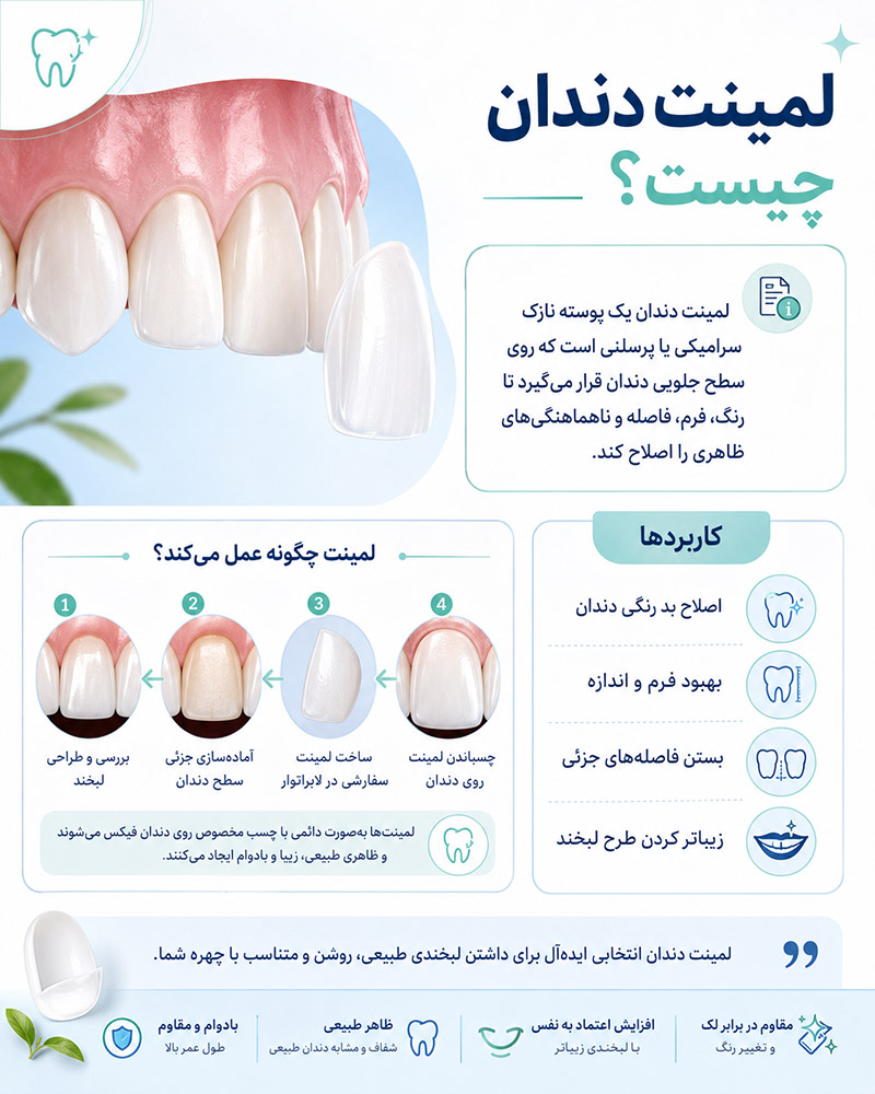 لمینت دندان چیست؟ 