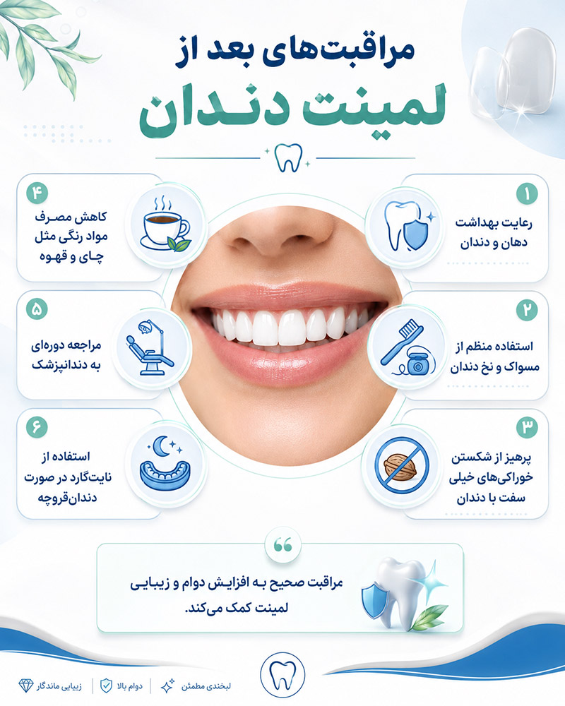 مراقبت های بعد از لمینت دندان