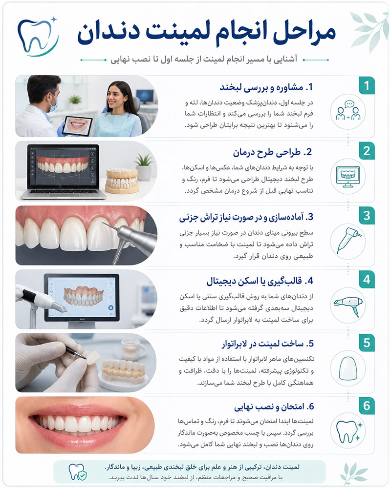مراحل انجام لمینت دندان