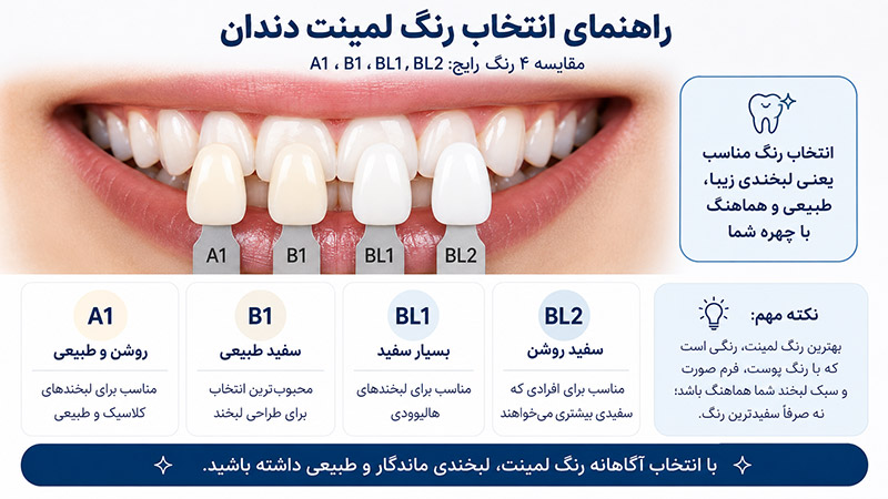 راهنمای انتخاب رنگ لمینت دندان