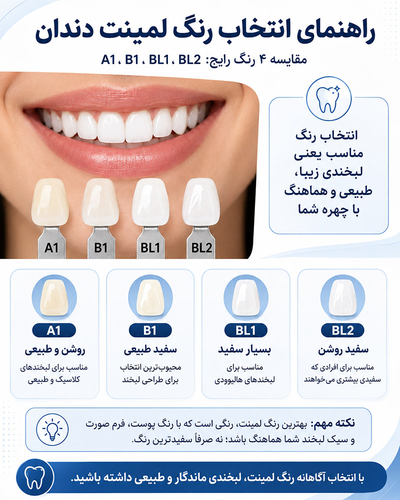 راهنمای انتخاب رنگ لمینت دندان