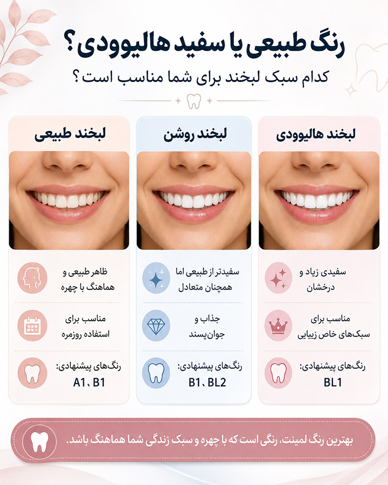 رنگ طبیعی یا هالیوودی لمینت
