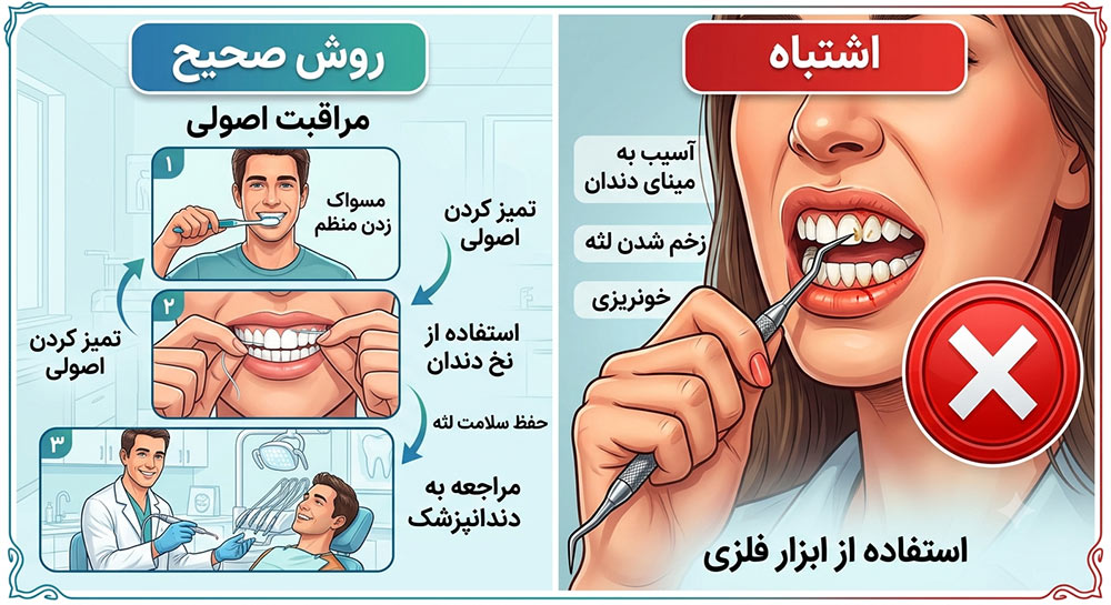 روش های خطرناک پاک کردن جرم دندان در خانه