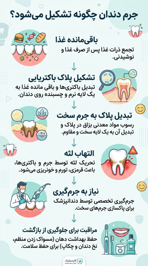 مسیر تشکیل جرم دندان از صفر تا درمان