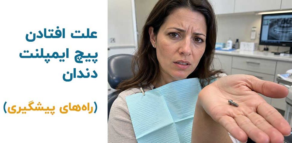 علت افتادن پیچ ایمپلنت دندان (راه‌های پیشگیری)