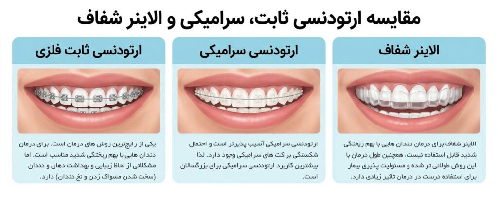 مقایسه ارتودنسی ثابت، سرامیک  و الاینر
