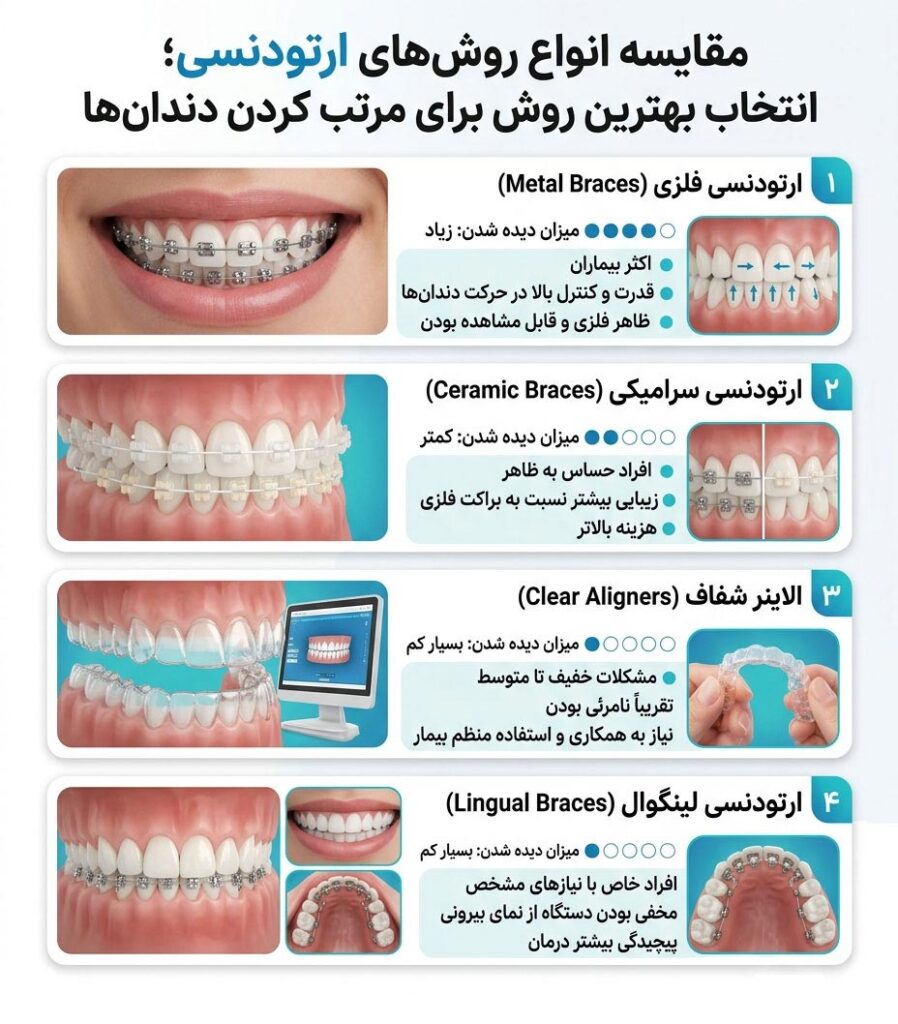 مقایسه انواع روش های ارتودنسی، فلزی، سرامیکی و شفاف