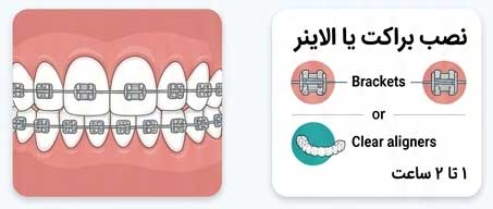 orthodontic-steps-05