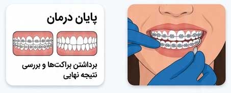 orthodontic-steps-08
