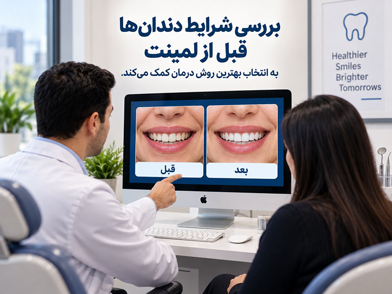 مشاوره دندانپزشک زیبایی قبل از انجام لمینت دندان