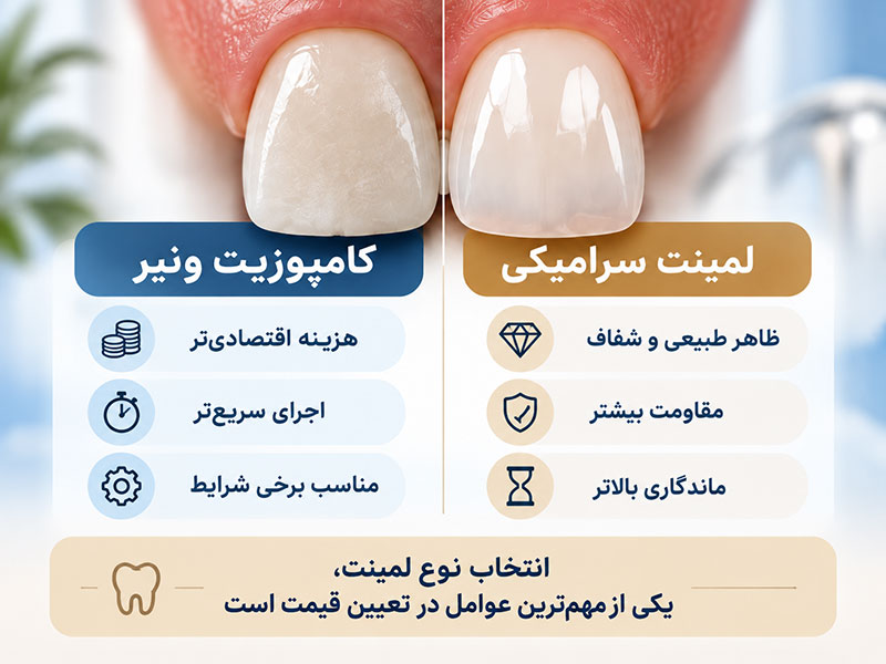 مقایسه لمینت سرامیکی و کامپوزیت ونیر از نظر کیفیت و هزینه