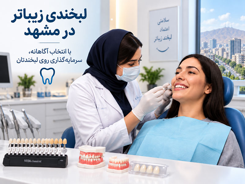 قیمت لمینت دندان در مشهد و عوامل موثر بر هزینه