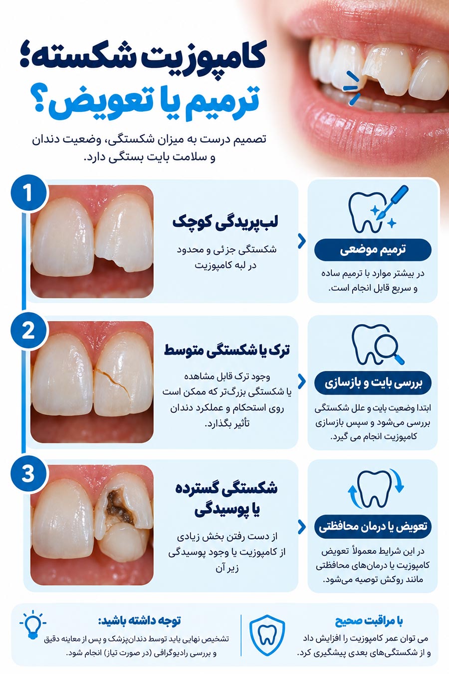 اینفوگرافیک ترمیم یا تعویض کامپوزیت