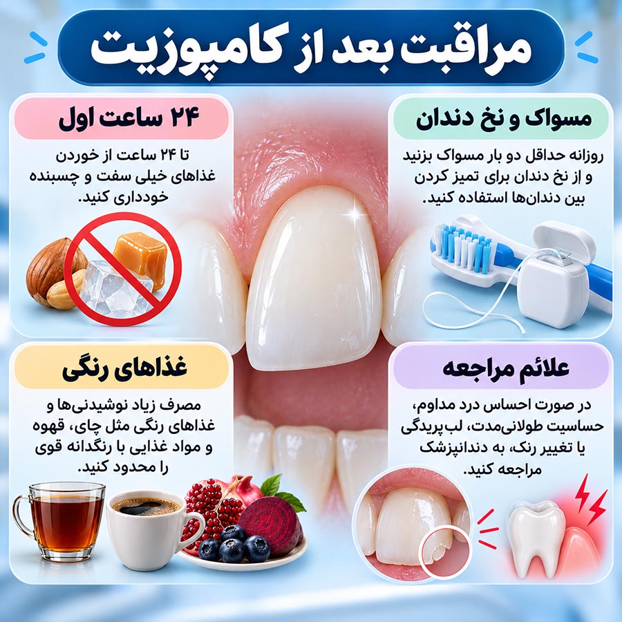اینفوگرافیک مراقبت بعد از کامپوزیت دندان