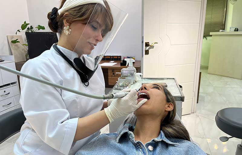پولیش حرفه‌ای دندان با ابزار چرخشی در مطب دندانپزشکی