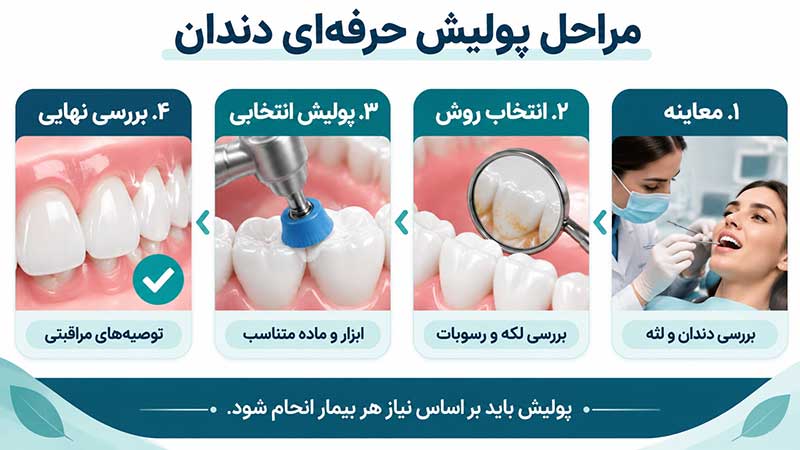مراحل پولیش حرفه‌ای دندان شامل معاینه، انتخاب روش، پولیش انتخابی و بررسی نهایی
